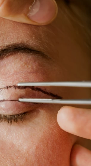 Plasztikai sebészet