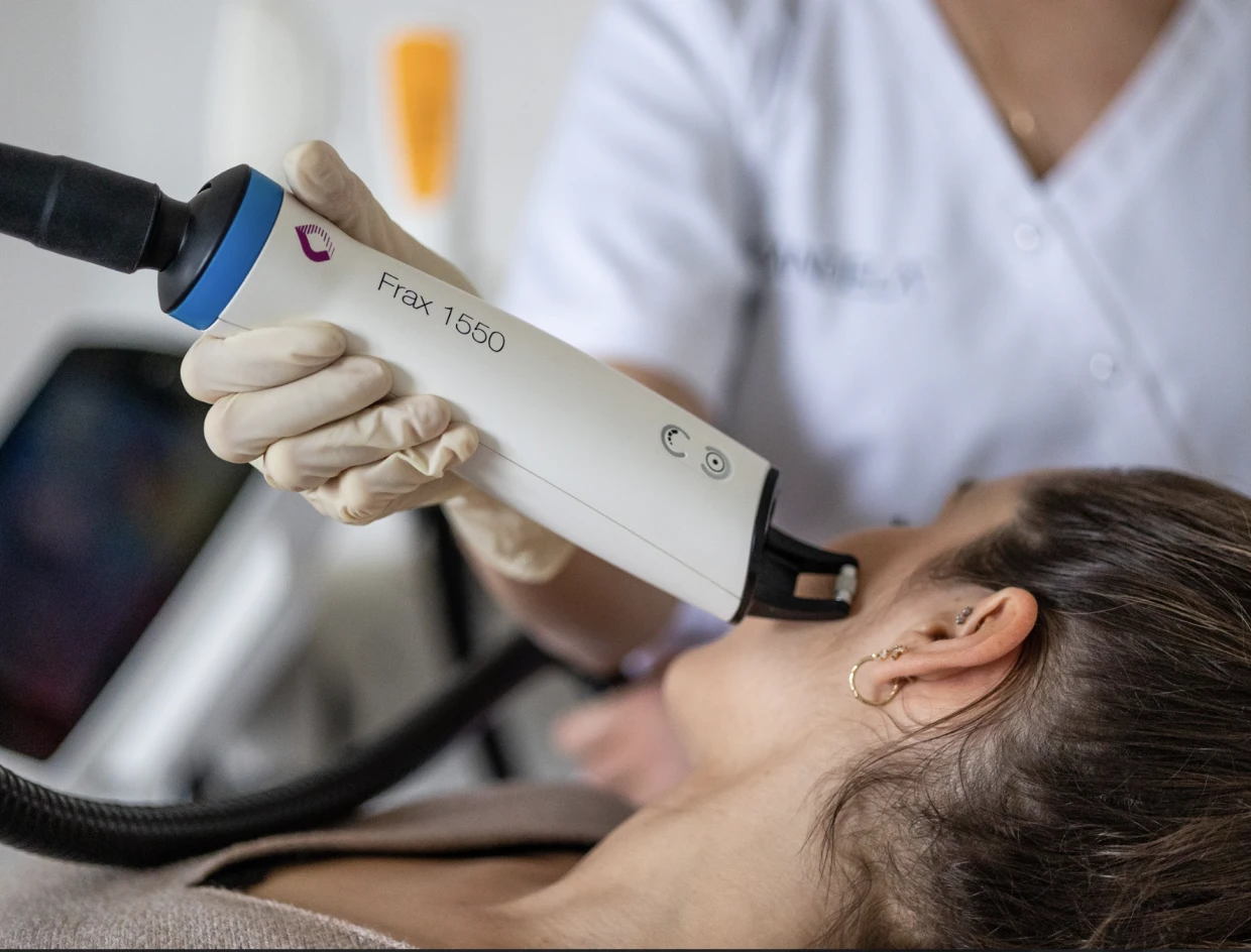 Candela Nordlys Frax Pro kezelés