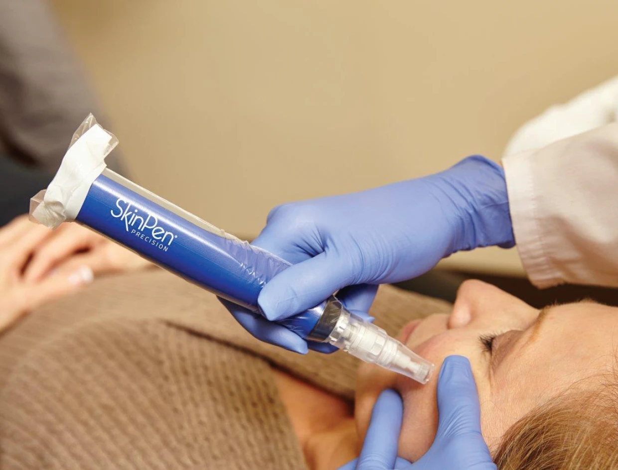 SkinPen Precision mikrotűs kezelés