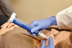 SkinPen Precision mikrotűs kezelés