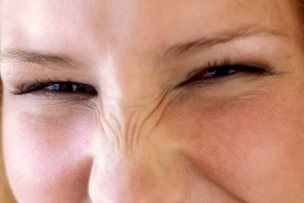 Nyuszi ráncok botox kezelése