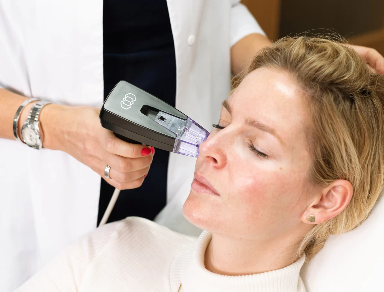 Morpheus 8 RF kezelés