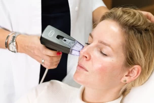 Morpheus 8 RF kezelés